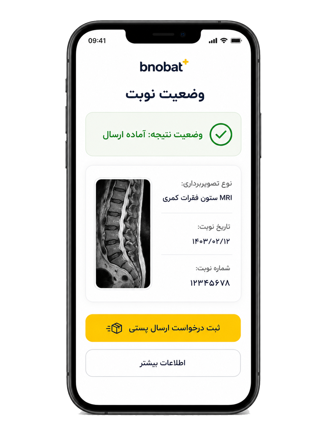 پیش‌نمایش وضعیت نتیجه و ثبت درخواست ارسال پستی در بی‌نوبت