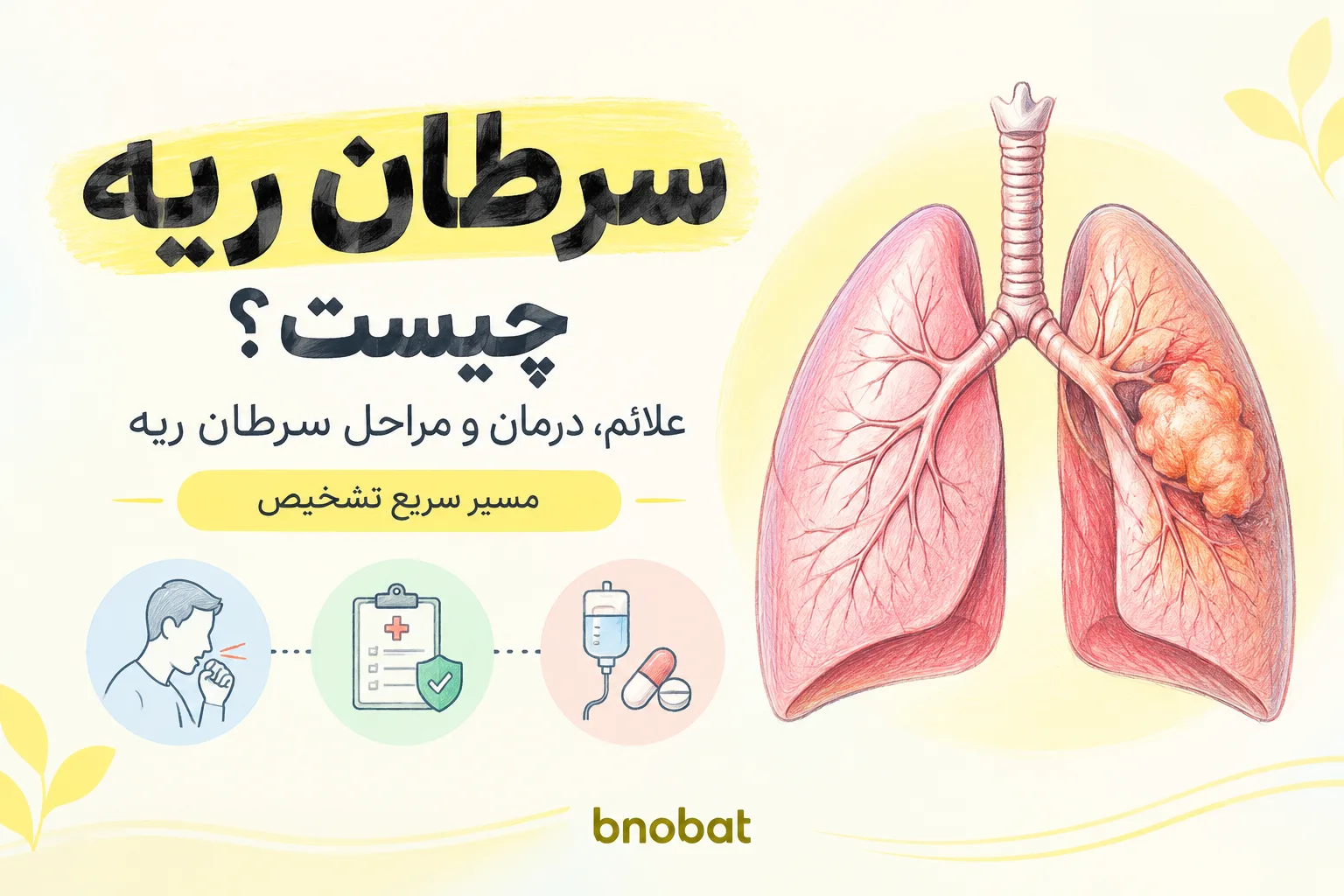 سرطان ریه چیست
