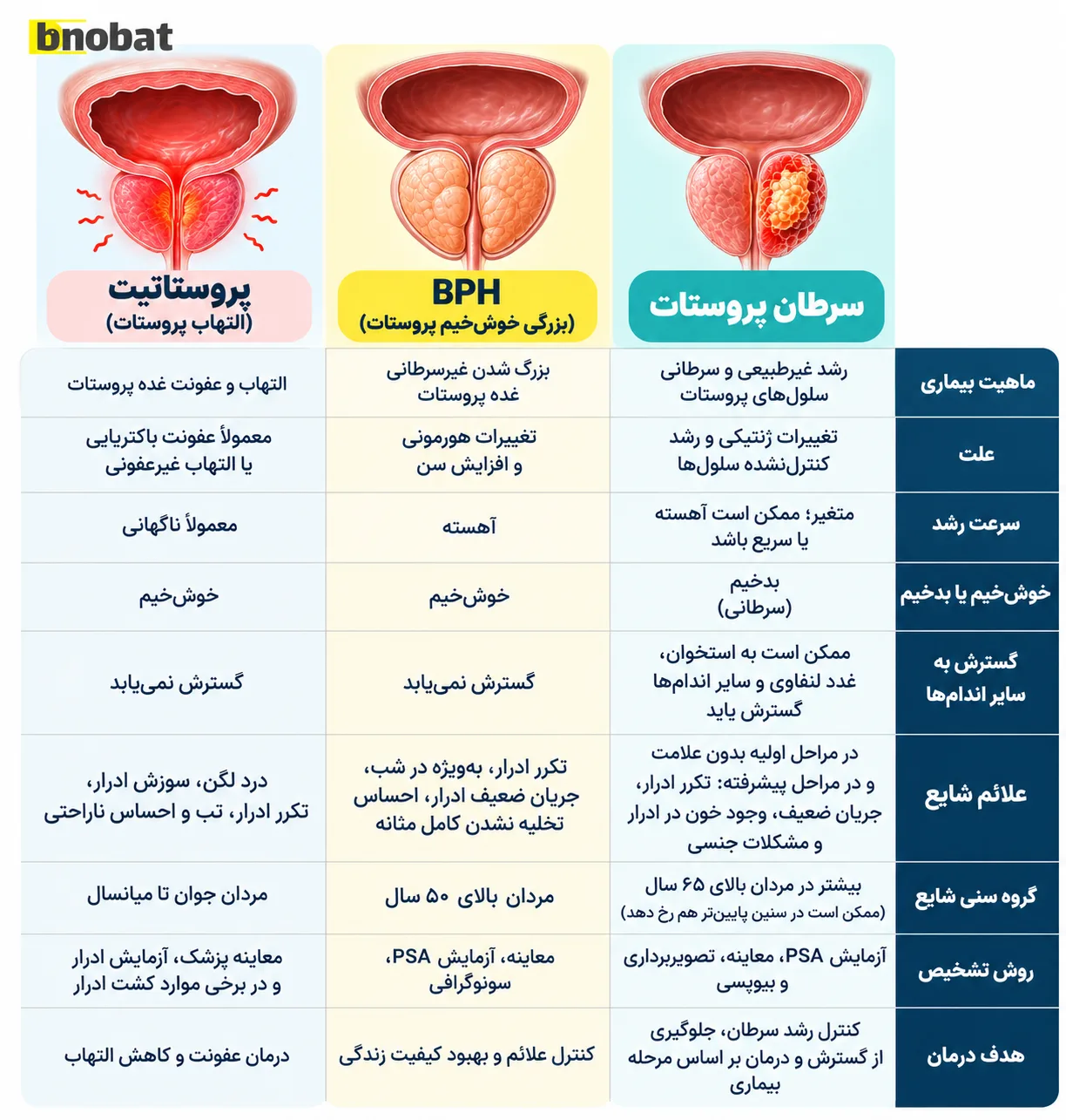 جدول سرطان پروستات