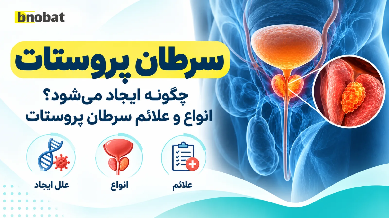 سرطان پروستات چگونه ایجاد میشود