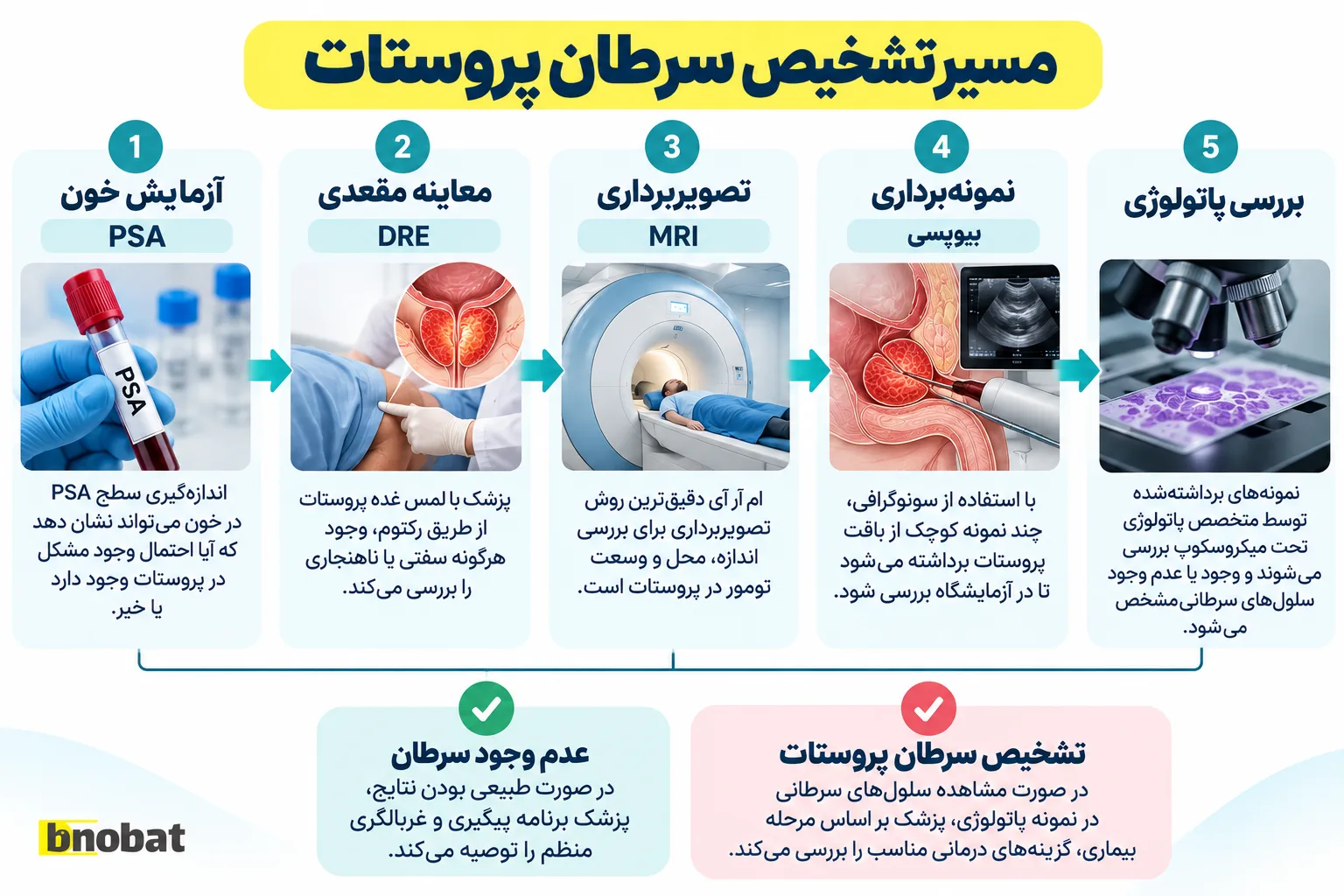 مسیر تشخیص سرطان پروستات