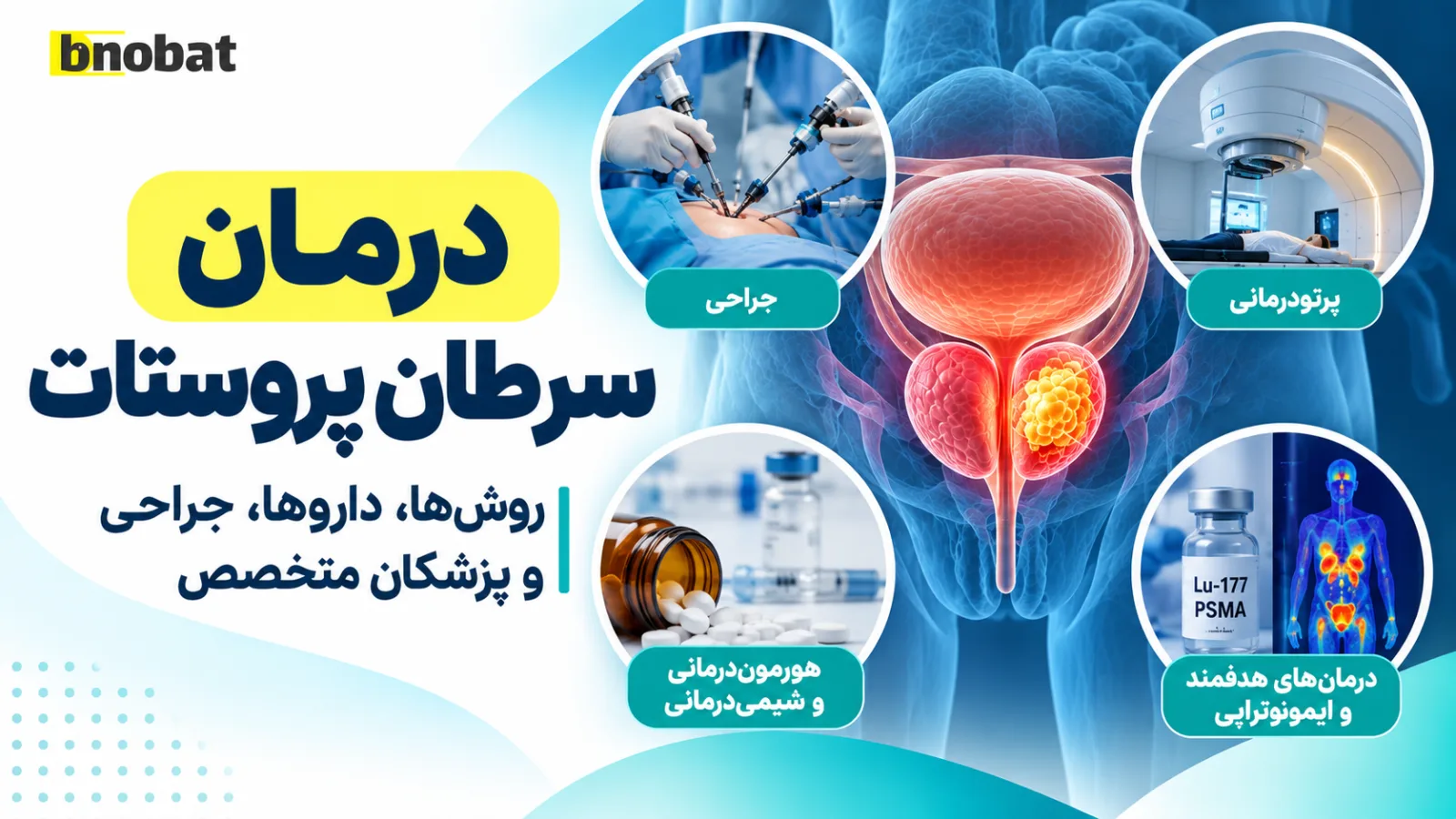 درمان سرطان پروستات